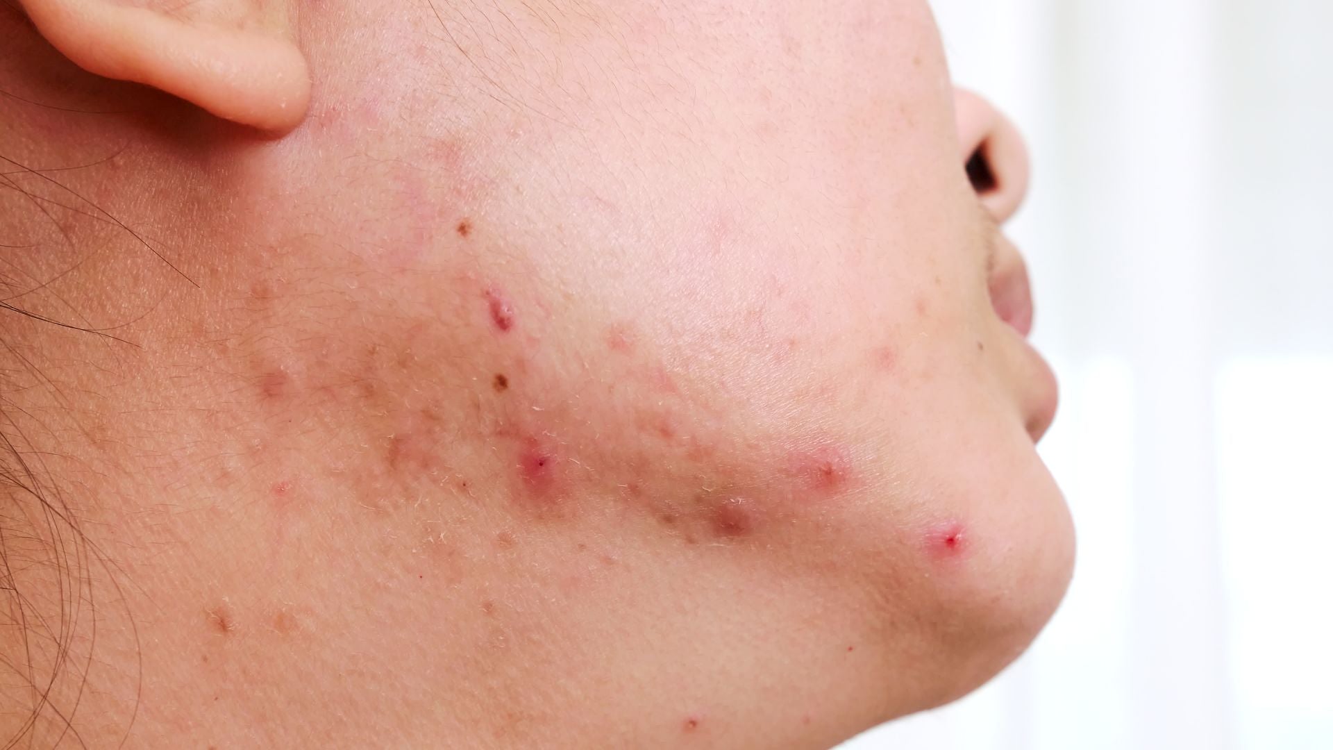 Gli integratori di fitoceramidi stimolano il collagene e aiutano a combattere i segni dell'età causati dalla perdita di idratazione - Vanity Fair Italia