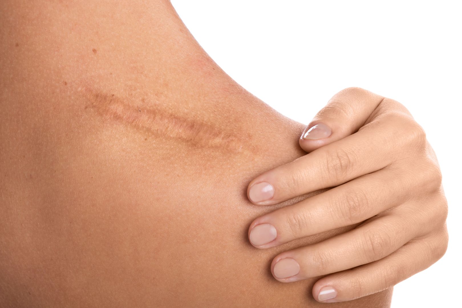 collagen with vitamin C menopause