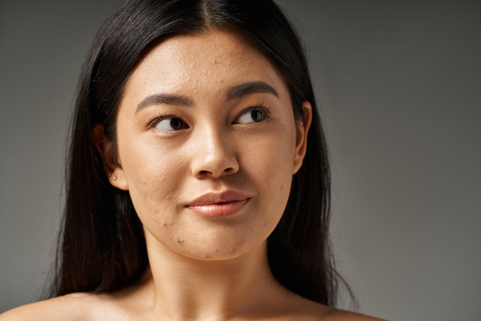 collagen and elastin